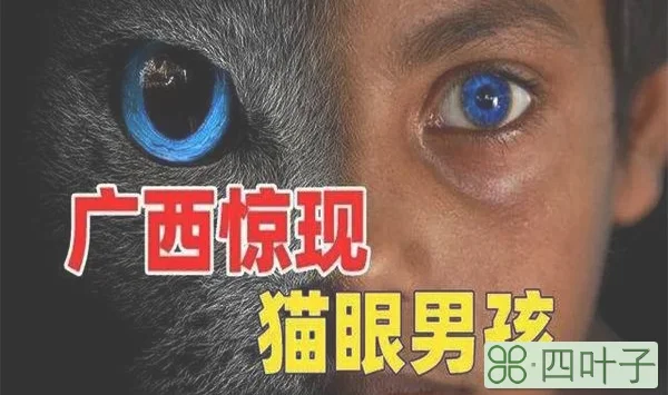 广西男孩天生夜视眼，夜晚看东西不用点灯，难道是猫妖转世？